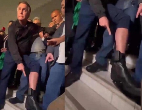 Jair Bolsonaro mostra tornozeleira eletrônica. Reprodução