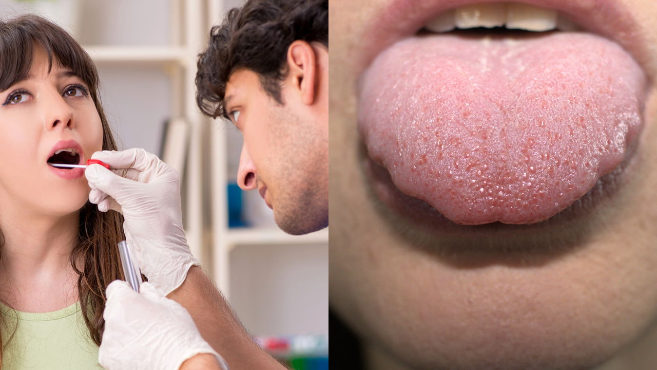 Saliva