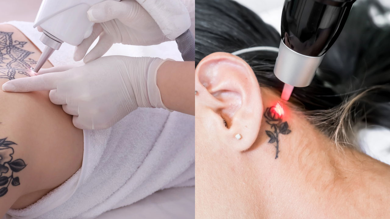 Tatuagem inteligente