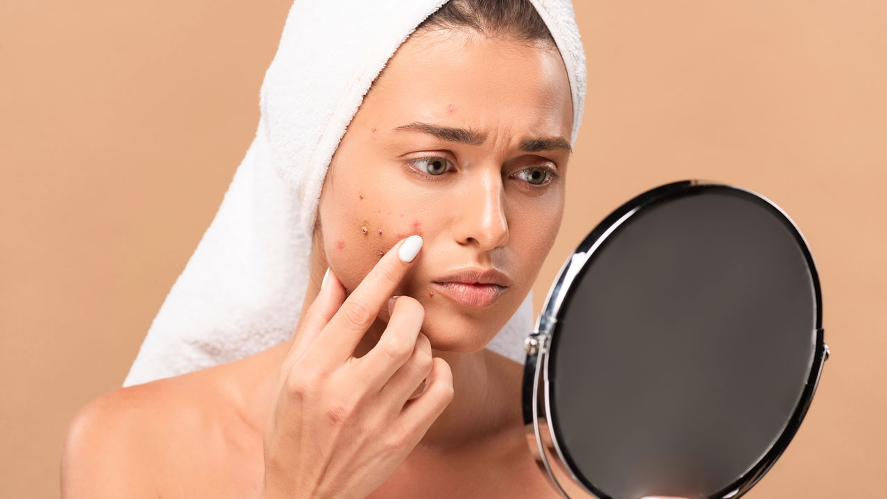 Dermatologista e acnes