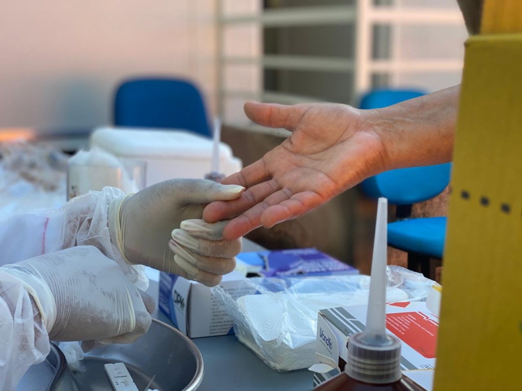 Prevenção contra o HIV