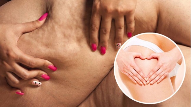 Reduza a celulite no seu corpo sem gastar fortunas Reduza a celulite no seu corpo sem gastar fortunas