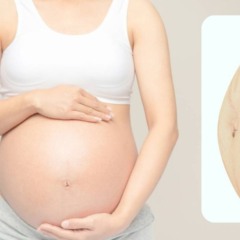 Estes cuidados com a pele reduzem o risco de estrias na gravidez Estes cuidados com a pele reduzem o risco de estrias na gravidez