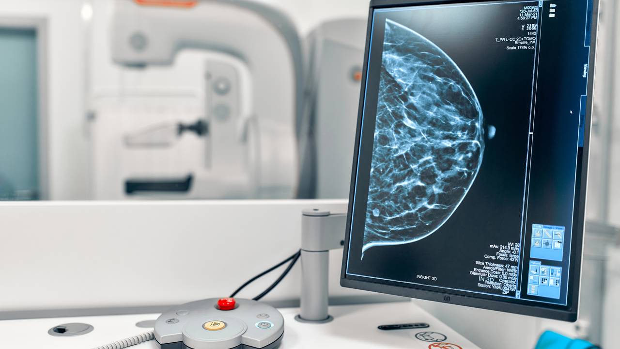 Saiba como o autocuidado faz a diferença na prevenção do câncer de mama