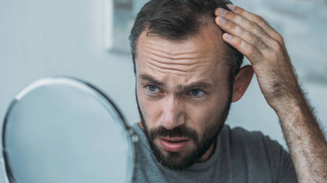 Estratégias para prevenir a calvície e cuidar dos cabelos