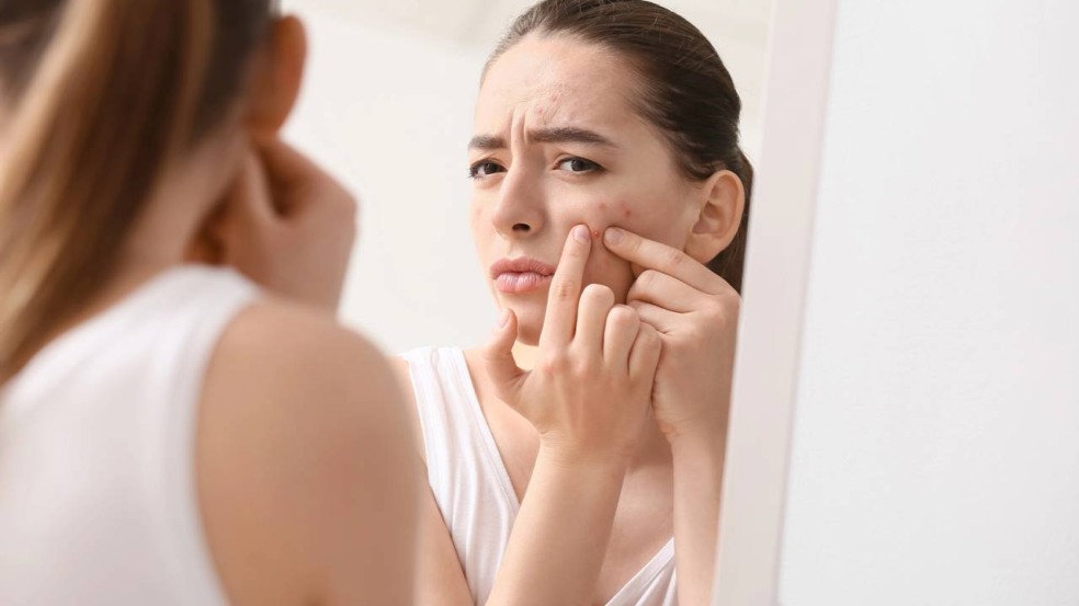 O tomilho se destaca como alternativa natural no tratamento da acne - Créditos: depositphotos.com / serezniy