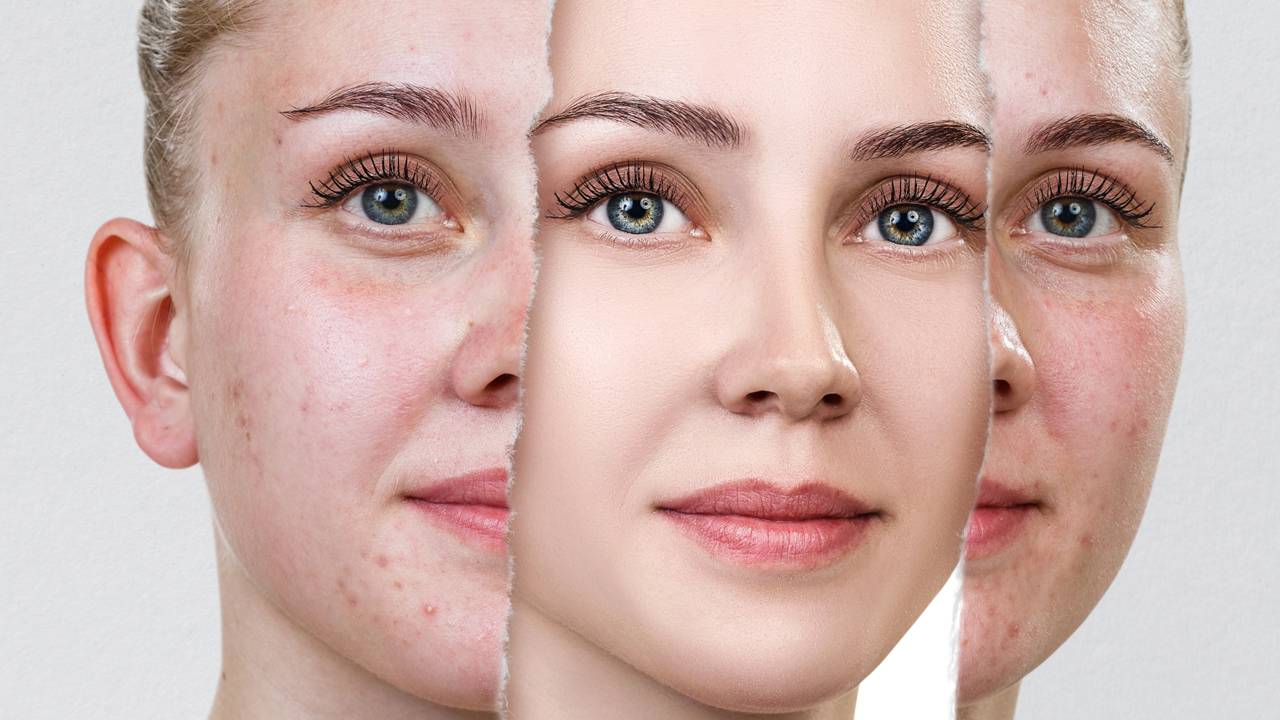 Essa receita caseira ajuda a clarear manchas da pele naturalmente