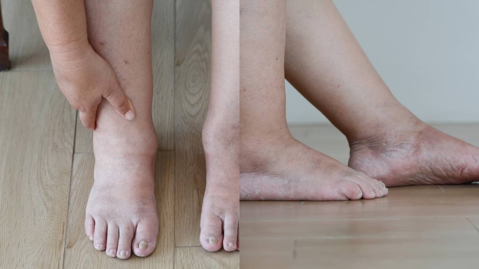 Há um conjunto de fatores que aumentam a probabilidade do problema - Créditos: depositphotos.com / toa55 / Créditos: depositphotos.com / toa55