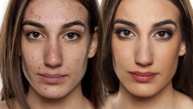 Nem sempre práticas simples de higiene são benéficas - Créditos: depositphotos.com / VGeorgiev