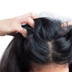 Um ponto que costuma gerar dúvidas é se a caspa passa de uma pessoa para outra - Créditos: depositphotos.com / sirinatestocker.gmail.com