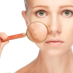 Imagem ilustrativa de cuidados com a pele voltados para o clareamento de manchas no rosto