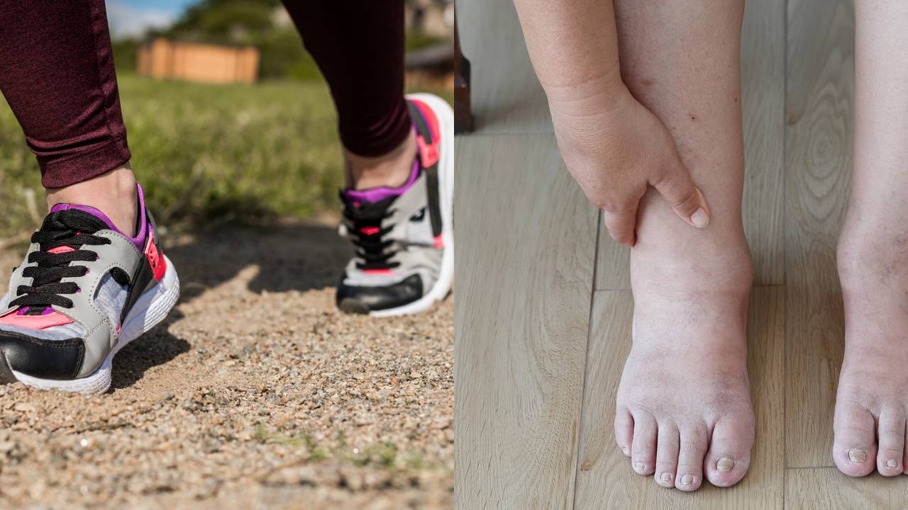 Inchaço no calor? Veja os exercícios que desincham as pernas