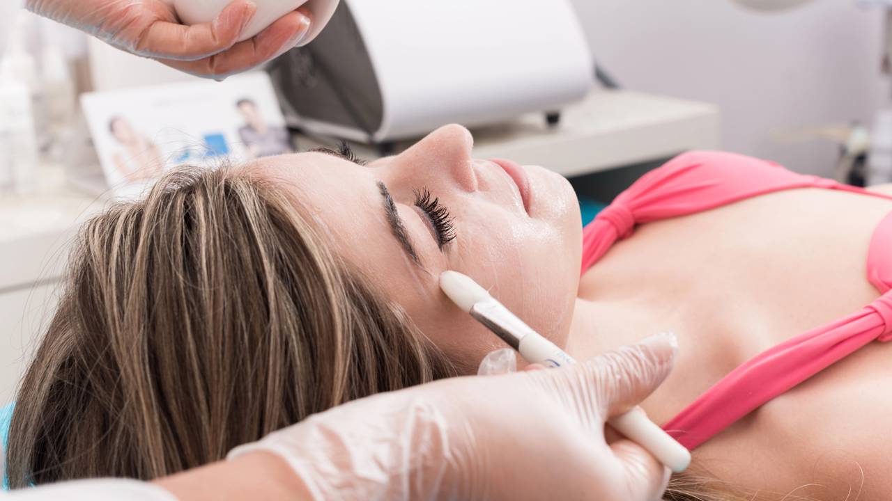 Tratamento de peeling qu&iacute;mico realizado por profissional para atenuar manchas no rosto