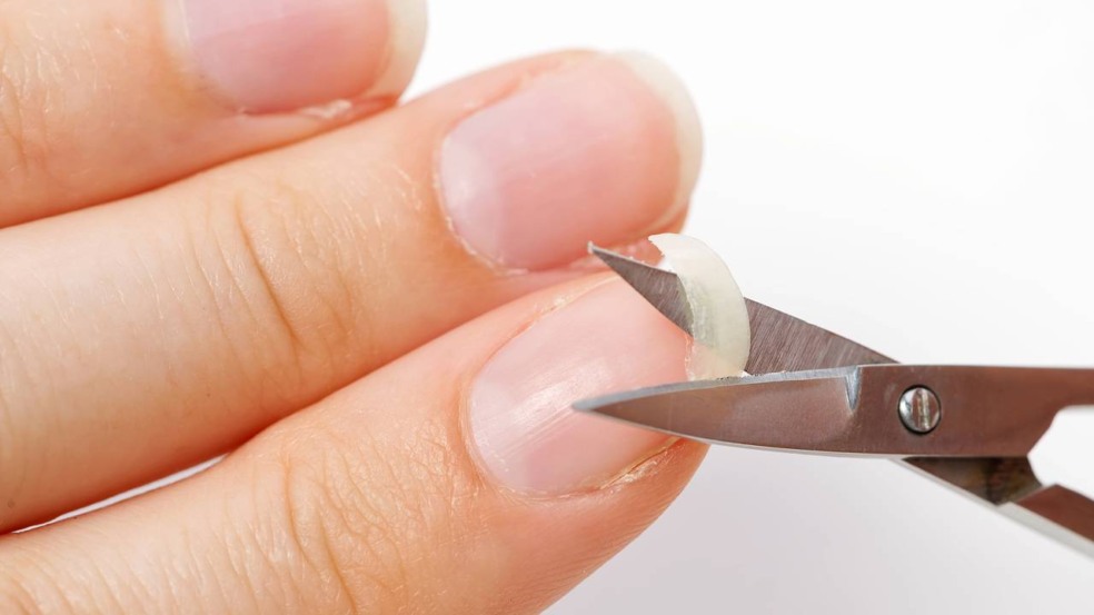 Antes de pensar em qualquer técnica de reparo, a recomendação é realizar uma higiene rápida da área - Créditos: depositphotos.com / FotoPrivet